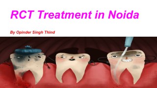 RCT Treatment in Noida