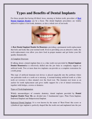 Types and Benefits of Dental Implants