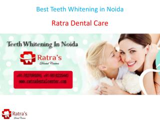Best Teeth Whitening in Noida