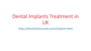 Dental implants treatment in UK