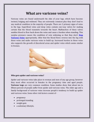 What are varicose veins