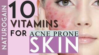 10 Essential Vitamins for Acne Prone Skin to Get Lighter Clear Skin