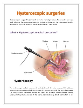 Hysteroscopy surgery