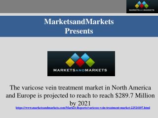 Varicose Vein Treatment Market: Market Intelligence and Global Forecast