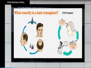 Hairline Clinic Turkey