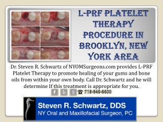 L-PRF Platelet Therapy Procedure in Brooklyn, New York area - NYOMSurgeons.com