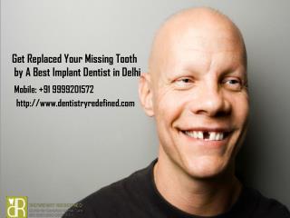 Get Replaced Your Missing Tooth by a Best Implant Dentist in Delhi