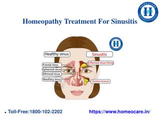 Homeopathy Treatment For Sinusitis