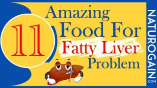 11 Amazing Foods for Fatty Liver Problem