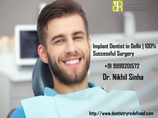 Implant Dentist in Delhi | 100% Successful Surgery