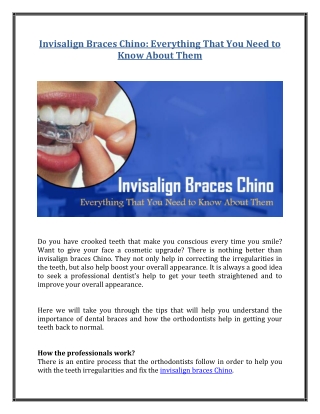 Invisalign Braces Chino: Everything That You Need to Know About Them