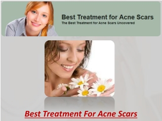 Best Treatment for Acne Scars