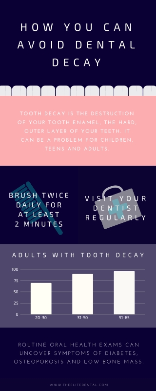 How You Can Avoid Dental Decay - Elite Dental Care Tracy