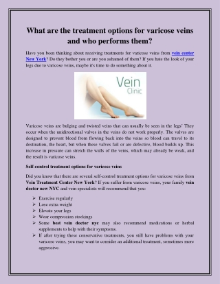What are the treatment options for varicose veins and who performs them