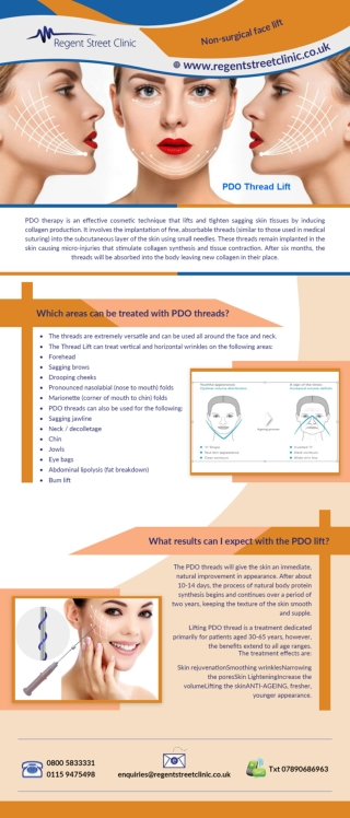 PDO Thread Lift
