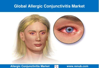 Allergic Conjunctivitis Market Outlook