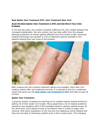 Avail the Best Spider Vein Treatment in NYC and Get Rid of Your Vein Problem