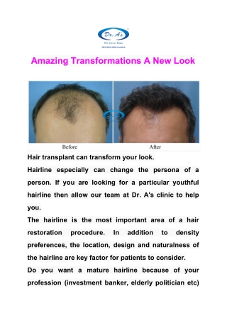 Amazing Transformations A New Look