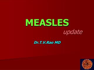 Measles