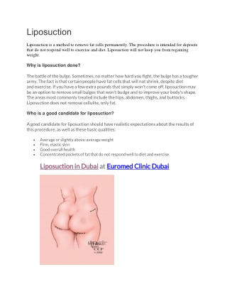 Liposuction (Full Guide)