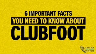 6 Important Facts You Need To Know About Clubfoot