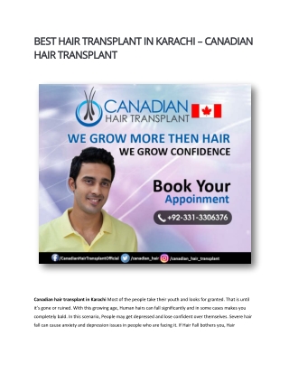 Best Hair Transplant in Karachi