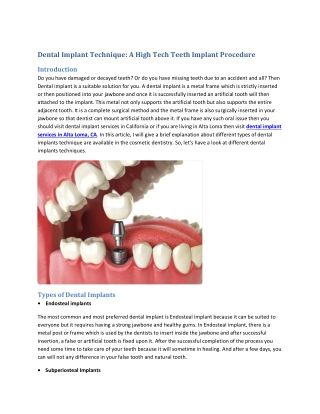 Dental Implant Technique a High Tech Teeth Implant Procedure