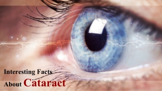 Interesting Facts About Cataract | Eye Care Tips