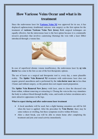 How Varicose Veins Occur and what is its treatment