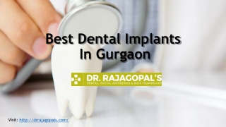 Dental implants in Gurgaon- Dr. RajaGopal's Clinic