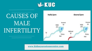 Causes Of Male Infertility