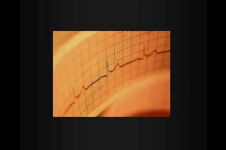 Acute Coronary Syndromes