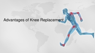 Advantages of Knee Replacement