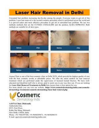 Laser Hair Removal in Delhi NCR