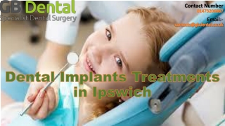 Dental Implants Treatments in Ipswich