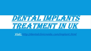 Dental Implants Treatment in UK