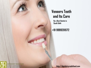 What are the Veneer Teeth and Its Care