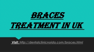 Braces Treatment in UK