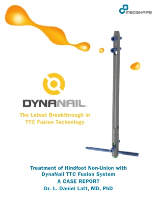 TTC & Hindfoot Fusion | Case Report – DynaNail® TTC Fusion System