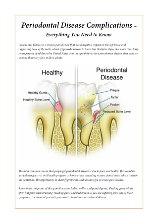 Periodontal Disease Complications – Everything You Need to Know