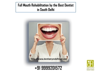 Full Mouth Rehabilitation by a Best Dentist in South Delhi