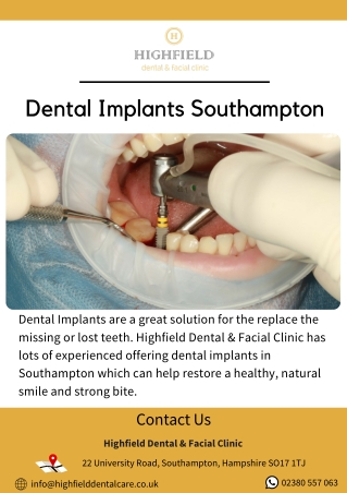 Dental Implants Southampton