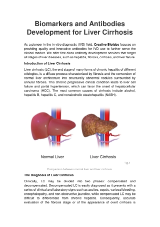 Biomarkers and Antibodies Development for Liver Cirrhosis