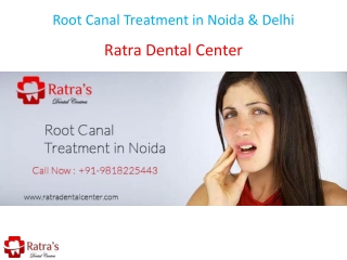 Root Canal Treatment in Noida & Delhi