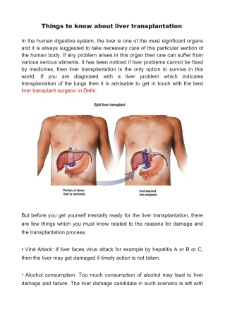 Things to know about liver transplantation