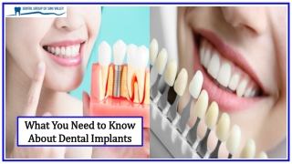 What you Need to Know About Dental Implants