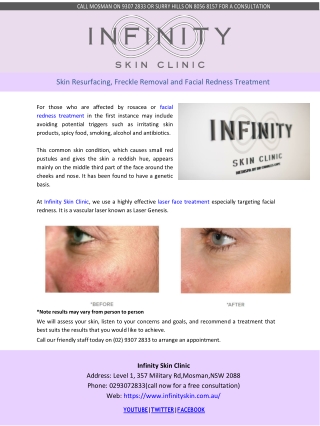 Skin Resurfacing, Freckle Removal and Facial Redness Treatment