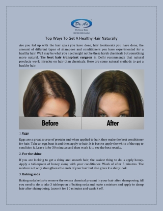 Female Hair Loss Treatment in Delhi