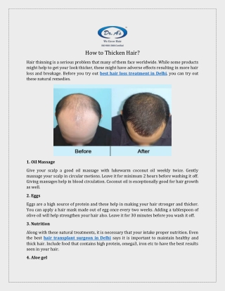 Hair Transplant Surgeon in Delhi