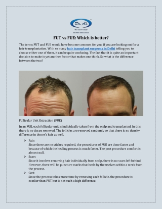 FUE and FUT Hair Transplant in Delhi